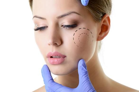 Médicos apontam quando parar com as plásticas e procedimentos no rosto -  Revista Marie Claire